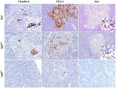 Corrigendum: Abnormalities of thymic stroma may contribute to immune dysregulation in murine models of leaky severe combined immunodeficiency